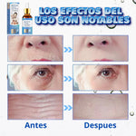 🌸🌺  Sérum Magic Botox – Rejuvenece tu piel sin agujas 🌺 🌸