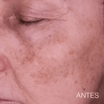 Jabón de Cúrcuma Natural -   ¡LIBERATE DE LAS MANCHAS Y EL ACNE! 🧼🍂 Paga 1 y Lleva 2😱