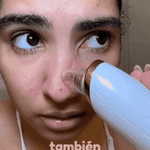✨ Succionador de Espinillas y Puntos Negros Profesional